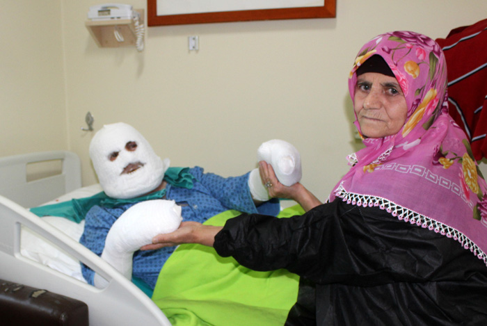 Sahur için yemek ısıtmaya çalışan aşçı, biriken gazın patlamasıyla yandı